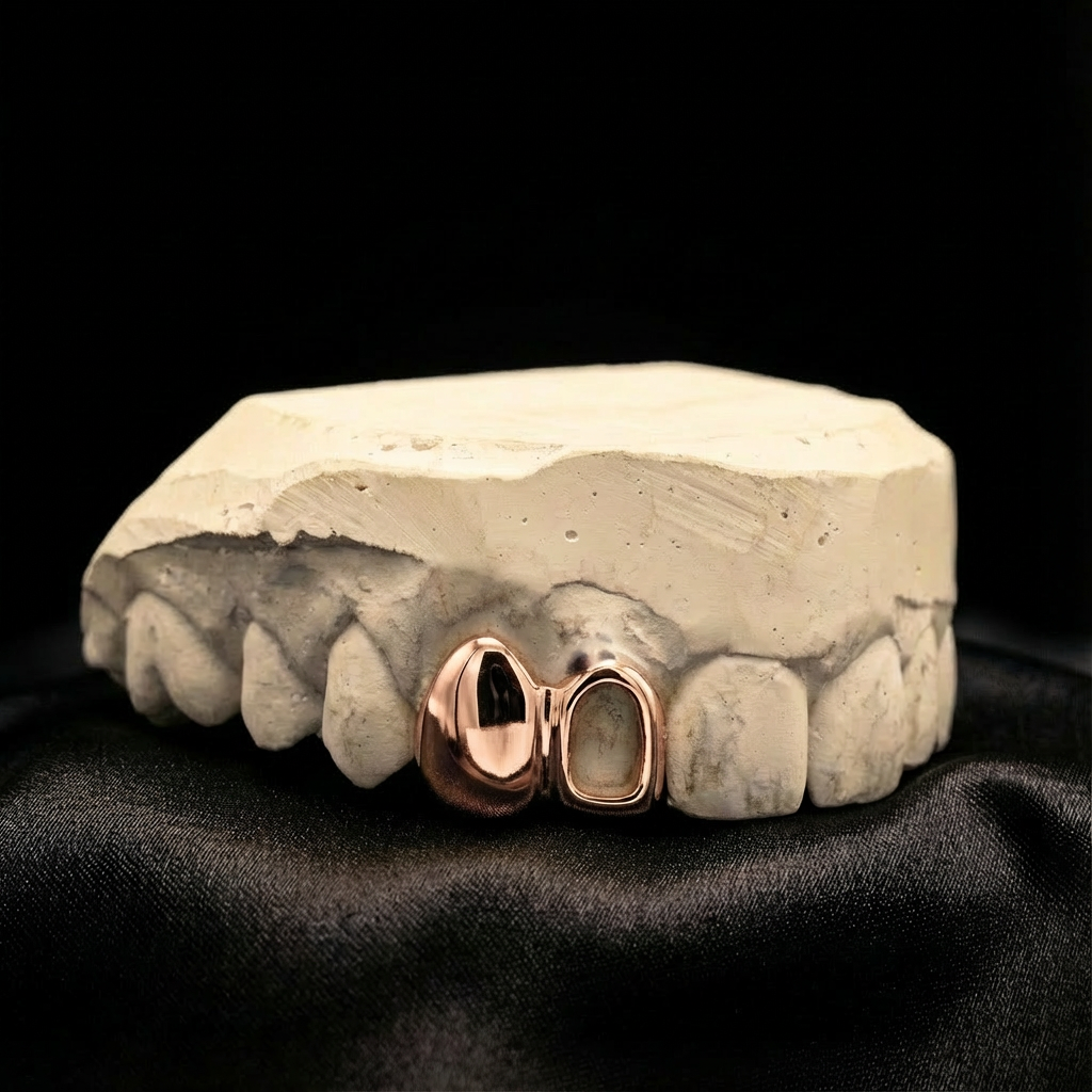 Custom rose gold grillz design full teeth and window