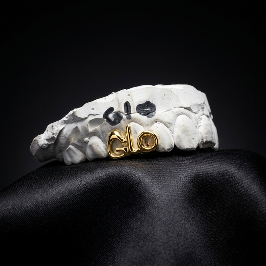 Polished 14K yellow gold custom "GLO" lettered grillz piece mounted on a plaster dental model over black satin fabric