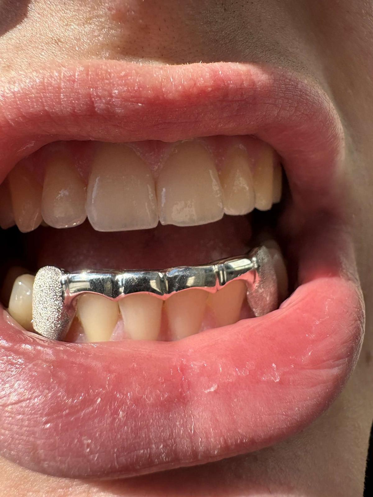 Custom silver grillz bar design with diamond dust on model 