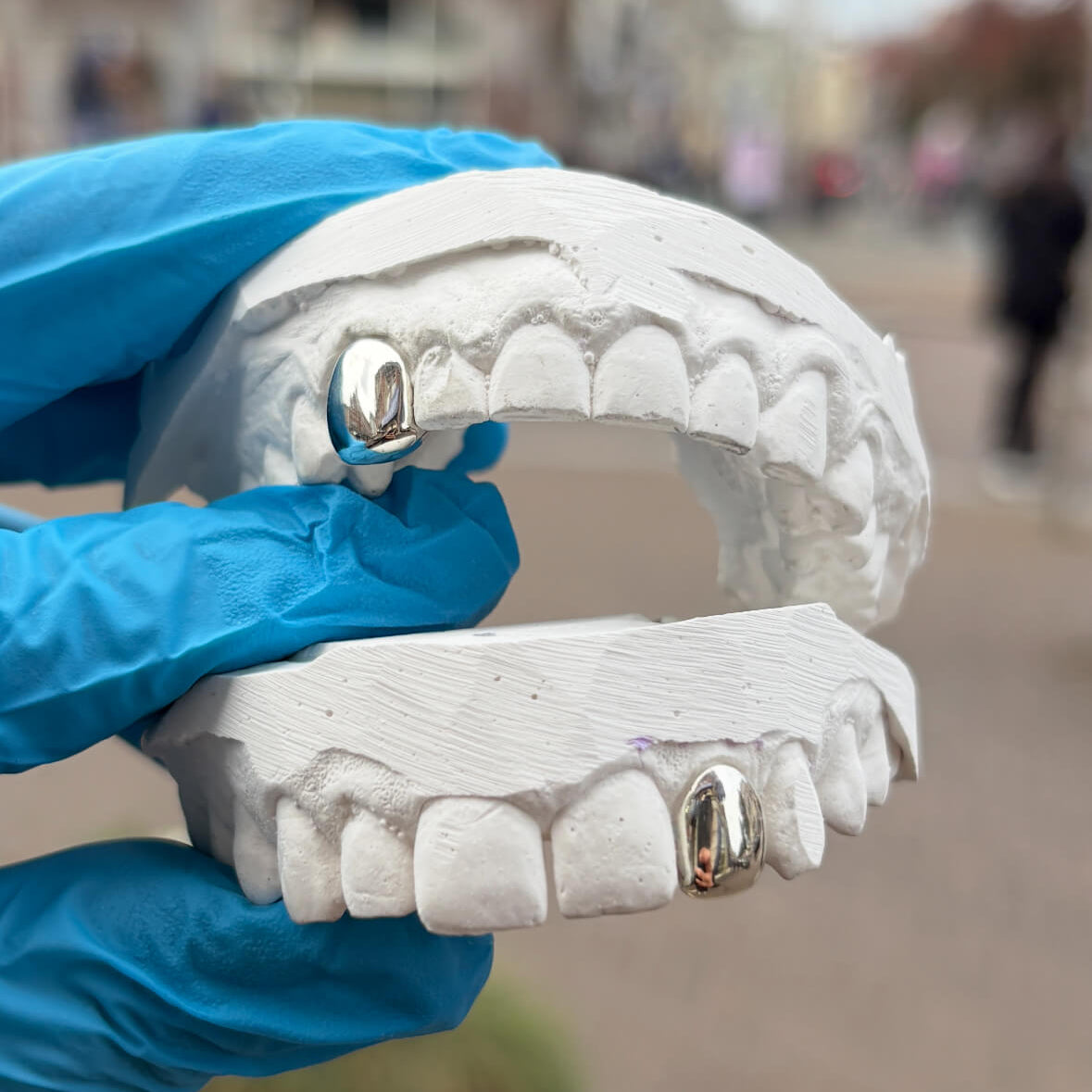 Two dental models featuring one silver grill each. Hand with blue gloves holds both Dental models on top of each other.