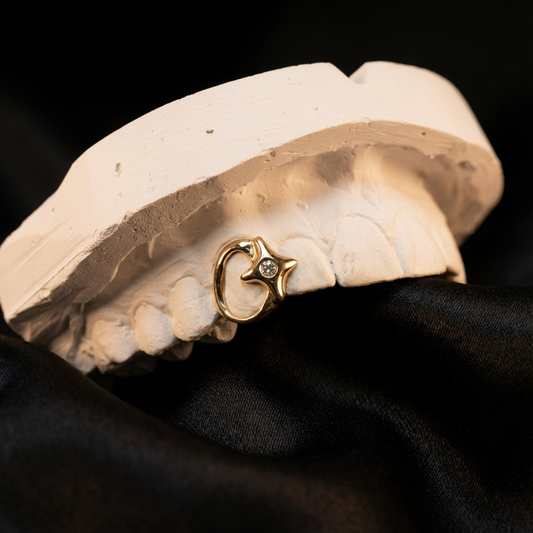 Yellow golden grillz with a custom design featuring an open face and a star set with a round diamond.
